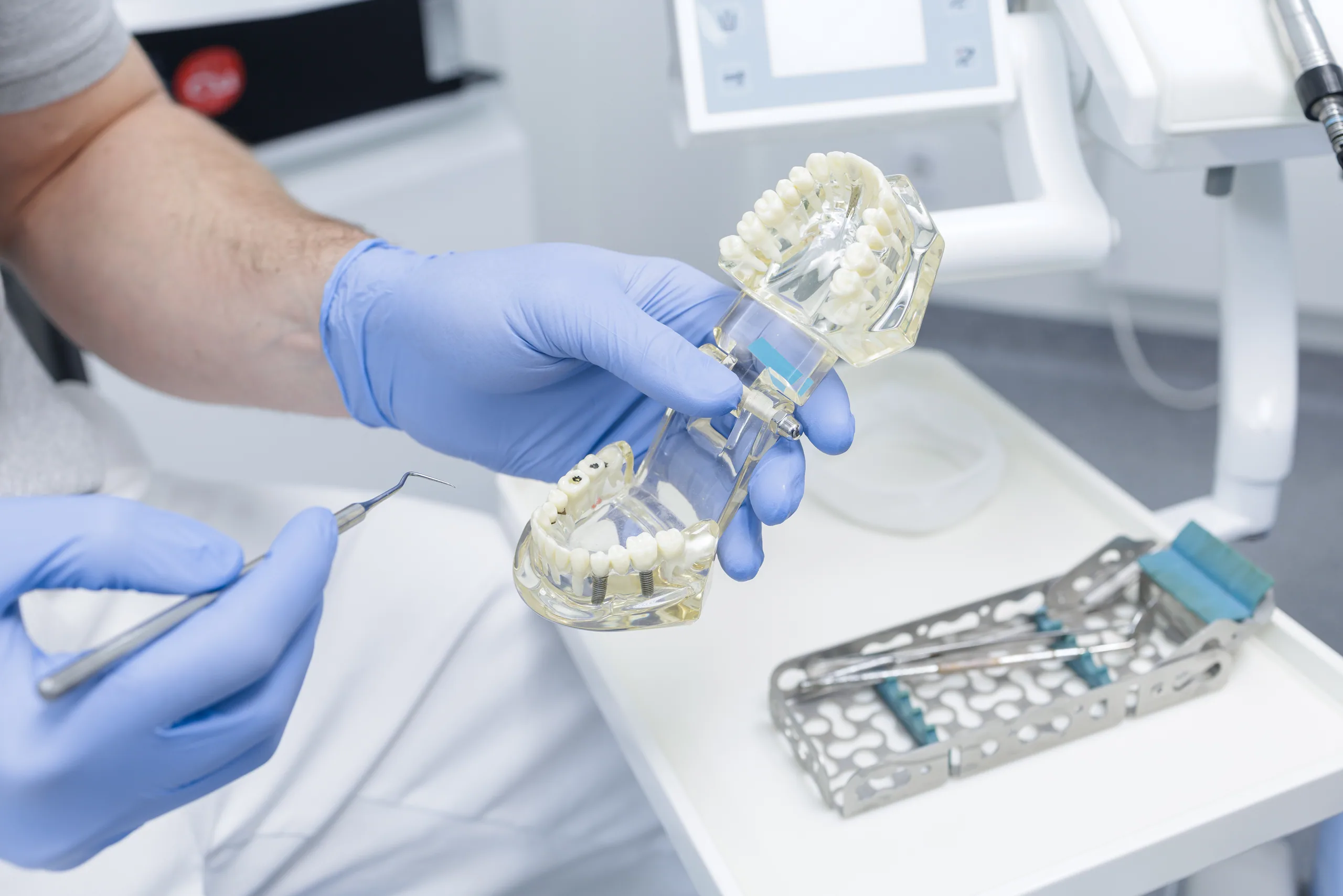Precision dental implant model representing restorative excellence